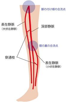 逆流防止弁が壊れやすい場所