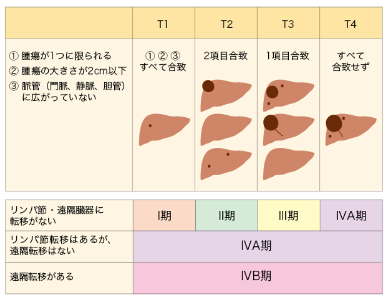 肝臓がんとは 北青山dクリニック