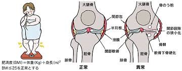 膝関節画像2