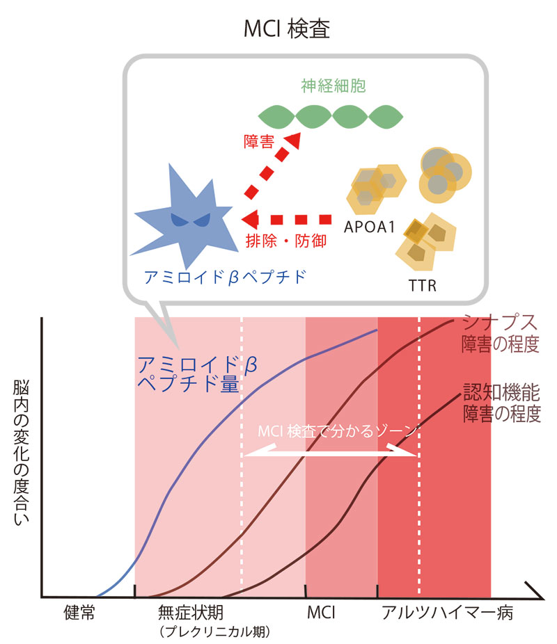 MCI検査