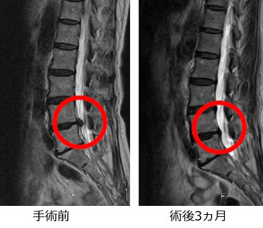 西の京病院 診療科のご案内 脊椎センター 主要対象疾患、手術の