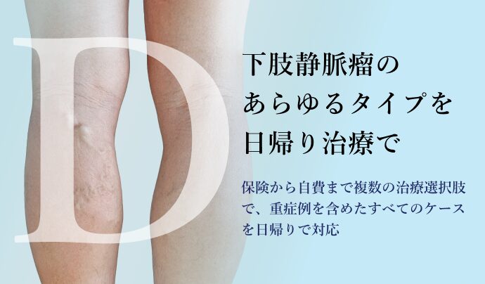 下肢静脈瘤レーザー治療