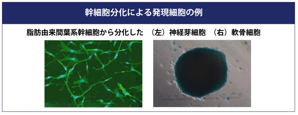 脂肪由来の幹細胞が実際に神経芽細胞や軟骨細胞に分化した顕微鏡写真